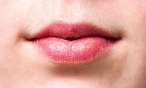 mouth, lips, dry lips-2160205.jpg